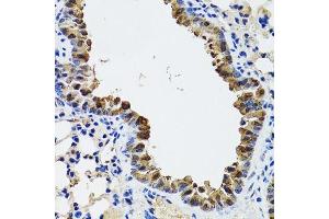 Immunohistochemistry of paraffin-embedded mouse lung using ESD antibody. (Esterase D antibody  (AA 1-282))