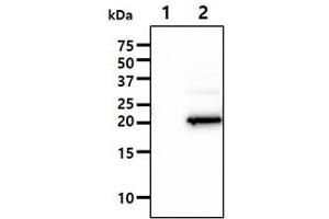 The Cell lysates (10ug) were resolved by SDS-PAGE, transferred to PVDF membrane and probed with anti-human IMP3 antibody (1:1000). (IMP3 antibody)