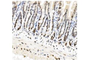 IHC analysis of HP1 alpha/CBX5 using anti-HP1 alpha/CBX5 antibody (ABIN7599058). (CBX5 antibody  (AA 1-191))