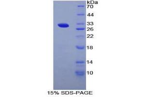 SDS-PAGE (SDS) image for Arginyl Aminopeptidase (Aminopeptidase B) (RNPEP) (AA 112-358) protein (His tag) (ABIN2124062)