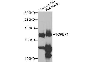 Western blot analysis of extracts of various cell lines, using TOPBP1 antibody (ABIN6291479) at 1:1000 dilution. (TOPBP1 antibody)