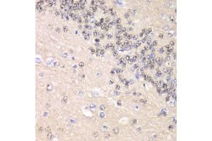 Immunohistochemistry of paraffin-embedded rat brain using CCNC antibody at dilution of 1:100 (x40 lens). (Cyclin C antibody)