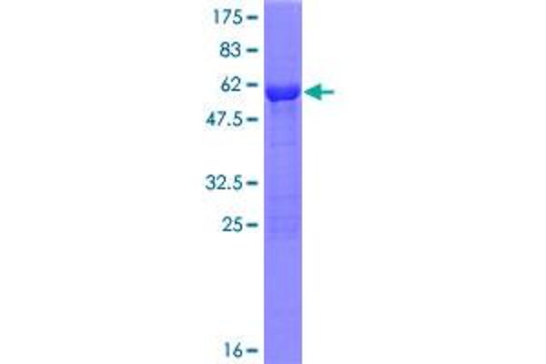 PMM1 Protein (AA 1-262) (GST tag)