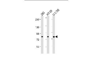 All lanes : Anti-ADD1 Antibody (Center) at 1:2000 dilution Lane 1: 293 whole cell lysate Lane 2: HT-29 whole cell lysate Lane 3: U-2 OS whole cell lysate Lysates/proteins at 20 μg per lane. (alpha Adducin antibody  (AA 428-462))