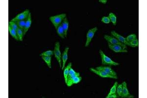 Immunofluorescent analysis of HepG2 cells using ABIN7147455 at dilution of 1:100 and Alexa Fluor 488-congugated AffiniPure Goat Anti-Rabbit IgG(H+L) (CERK antibody  (AA 212-478))