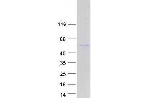 Validation with Western Blot (PSD3 Protein (Transcript Variant 2) (Myc-DYKDDDDK Tag))