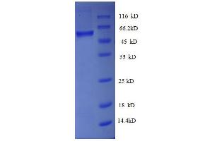 ATPase, H+ Transporting, Lysosomal 31kDa, V1 Subunit E1 (ATP6V1E1) (AA 2-224), (partial) protein (GST tag)