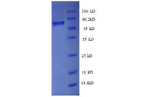 ATPase, H+ Transporting, Lysosomal 31kDa, V1 Subunit E1 (ATP6V1E1) (AA 2-224), (partial) protein (GST tag) (ATP6V1E1 Protein (AA 2-224, partial) (GST tag))