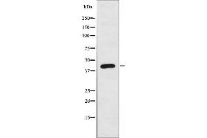 Western blot analysis of extracts from Jurkat cells, using BLZF1 antibody.
