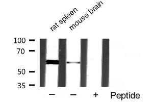 Western blot analysis of extracts of various samples,using akt2 antibody. (AKT2 antibody  (C-Term))