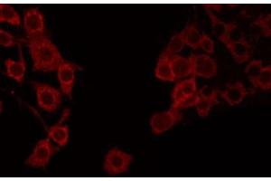 ABIN6272243 staining COLO205 by IF/ICC. (APOOL antibody  (C-Term))