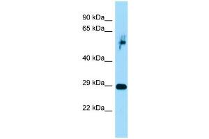 Host:  Rabbit  Target Name:  Prrx1  Sample Type:  Rat Pancreas lysates  Antibody Dilution:  1. (PRRX1 antibody  (C-Term))