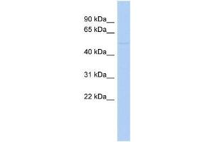 Human COLO205; WB Suggested Anti-ZNF669 Antibody Titration: 0.