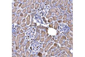 IHC analysis of p57 Kip2/CDKN1C using anti-p57 Kip2/CDKN1C antibody (ABIN7603232). (CDKN1C antibody  (N-Term))
