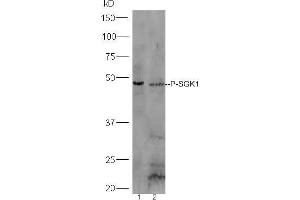 Western Blotting (WB) image for anti-serum/glucocorticoid Regulated Kinase 1 (SGK1) (pSer78) antibody (ABIN745688)
