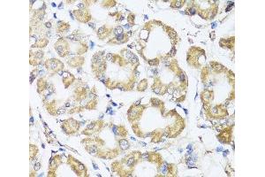 Immunohistochemistry of paraffin-embedded Human stomach using B9D1 Polyclonal Antibody at dilution of 1:100 (40x lens). (B9D1 antibody)