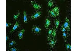 IF analysis of MMP1 using anti-MMP1 antibody (ABIN7599873). (MMP1 antibody  (AA 124-469))