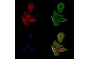 Phospho-p53 (Ser33) Antibody staining Hela cells(heat shock treatment) by IF/ICC. (p53 antibody  (pSer33))