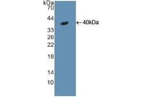Western blot analysis of recombinant Rat KRT18. (Cytokeratin 18 antibody  (AA 72-380))
