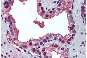 Human Prostate: Formalin-Fixed, Paraffin-Embedded (FFPE) (PABPN1 antibody  (N-Term))