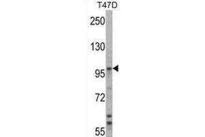 Western Blotting (WB) image for anti-Ubiquitin Protein Ligase E3A (ube3a) antibody (ABIN3001484) (ube3a antibody)