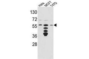 Image no. 1 for anti-FK506 Binding Protein 4, 59kDa (FKBP4) (Middle Region) antibody (ABIN453015) (FKBP4 antibody  (Middle Region))