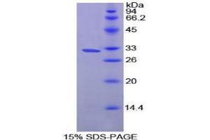 SDS-PAGE analysis of Rat Prolylcarboxypeptidase Protein.
