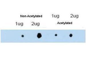 affinity purified anti-ATDC antibody shows reactivity by dot blot with acetylated and non-acetylated forms of the immunizing peptide. (TRIM29 antibody  (Internal Region))