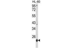 Western blot analysis of PSMB9 Antibody (C-term) in HL-60 cell line lysates (35ug/lane). (PSMB9 antibody  (C-Term))