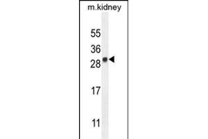 LYPD4 Antibody (Center) (ABIN654302 and ABIN2844090) western blot analysis in mouse kidney tissue lysates (35 μg/lane).