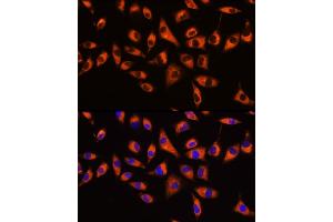 Immunofluorescence analysis of L929 cells using GNB2 Rabbit pAb  at dilution of 1:100 (40x lens). (GNB2 antibody  (AA 1-340))