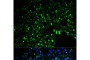 Immunofluorescence analysis of HeLa cells using UGDH Polyclonal Antibody (UGDH antibody)
