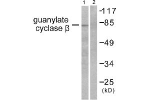 Western blot analysis of extracts from HuvEc cells, using Guanylate Cyclase β antibody (#C0219). (GUCYB antibody)