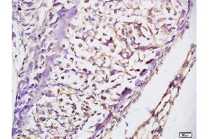 Formalin-fixed and paraffin embedded rat lung labeled with Anti Prkg1/cGKI Polyclonal Antibody, Unconjugated (ABIN720221) at 1:200 followed by conjugation to the secondary antibody and DAB staining (PRKG1 antibody)