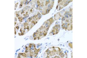 Immunohistochemistry of paraffin-embedded human stomach using MGP antibody at dilution of 1:100 (40x lens). (MGP antibody)