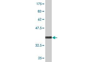 Western Blot detection against Immunogen (36. (DPYSL5 antibody  (AA 466-564))