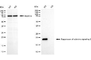 Western blotting analysis using suppressor of cytokine signaling 2 antibody (ABIN7800465). (Recombinant SOCS2 antibody)