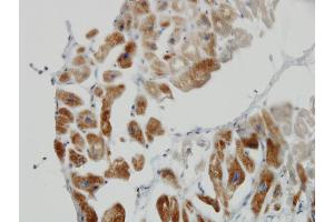 Immunoperoxidase of monoclonal antibody to DLD on formalin-fixed paraffin-embedded human heart. (DLD antibody  (AA 1-509))