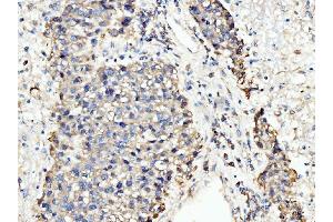 IHC analysis of BCKDK using anti-BCKDK antibody (ABIN7601470).