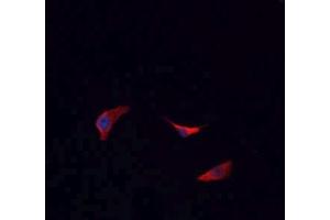 ABIN6266693 staining HeLa cells by IF/ICC. (BCKDK antibody  (N-Term))