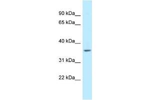 WB Suggested Anti-WBSCR22 Antibody Titration: 1. (WBSCR22 antibody  (C-Term))
