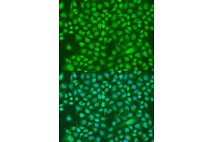 Immunofluorescence analysis of U2OS cells using KDM7A antibody (ABIN6293223) at dilution of 1:100. (JHDM1D antibody)