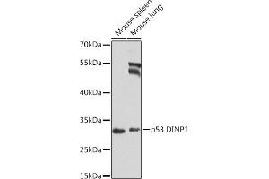 Western blot analysis of extracts of various cell lines, using p53 DINP1 antibody (ABIN6133846, ABIN6149422, ABIN6149423 and ABIN6224287) at 1:1000 dilution. (TP53INP1 antibody  (AA 1-100))