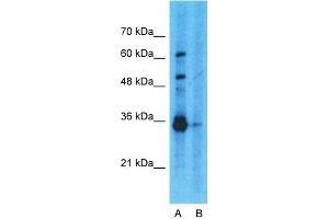Host:  Rabbit  Target Name:  GAPDH  Sample Type:  293T  Lane A:  Primary Antibody  Lane B:  Primary Antibody + Blocking Peptide  Primary Antibody Concentration:  1ug/ml  Peptide Concentration:  5ug/ml  Lysate Quantity:  25ug/lane/lane  Gel Concentration:  0. (GAPDH antibody  (N-Term))