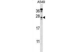 Western Blotting (WB) image for anti-Chromosome 4 Open Reading Frame 49 (C4orf49) antibody (ABIN2998187)