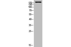Western Blot analysis of customer's (cat sample) using Laminin γ-1 Polyclonal Antibody (Laminin gamma 1 antibody  (C-Term))