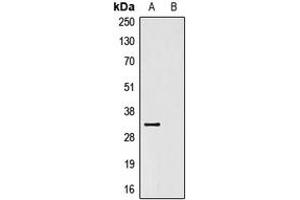 Western blot analysis of Anti-V5-tag Antibody against HEK293T cells transfected with vector overexpressing V5 tag (A) and untransfected (B). (V5 Epitope Tag antibody)