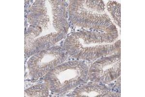 Immunohistochemical staining of human stomach with LRCH2 polyclonal antibody  shows cytoplasmic and membranous positivity in glandular cells.