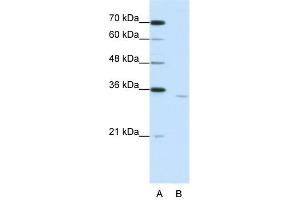 WB Suggested Anti-CPEB2 Antibody Titration:  1. (CPEB2 antibody  (Middle Region))