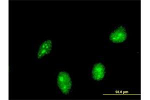 Immunofluorescence (IF) image for anti-Hypermethylated in Cancer 1 (HIC1) (AA 396-453) antibody (ABIN516437)
